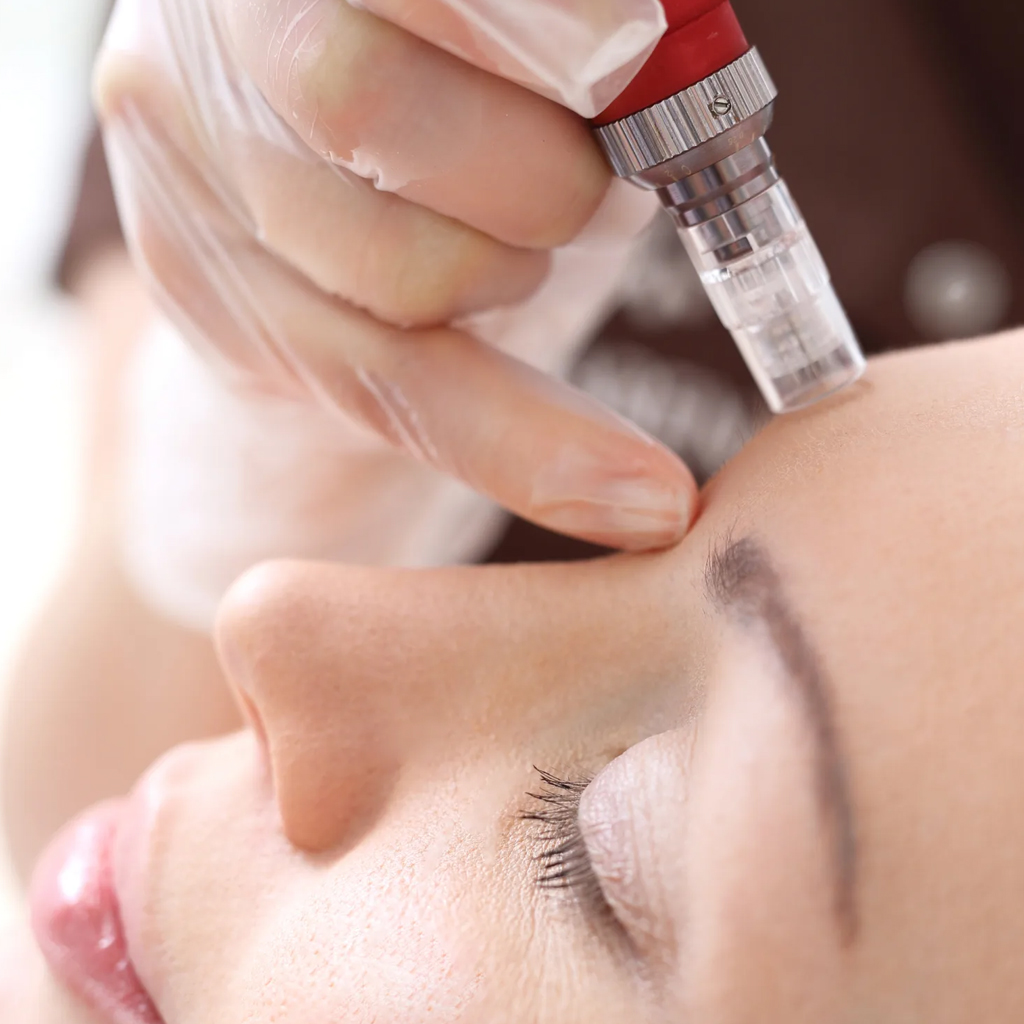Micro Needling